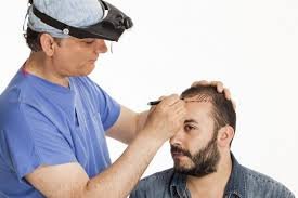 Understanding The Varying Costs Of Hair Transplant